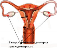������� ������������ �����