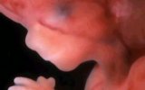 14-�� ������ ������������ - ����� �����������
