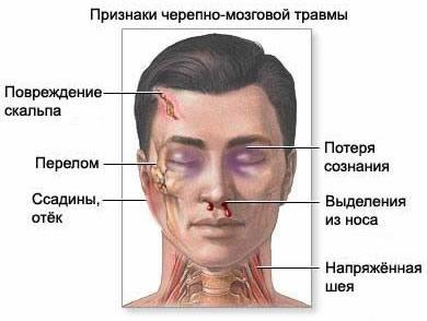 Потеря сознания: причины и оказание первой помощи