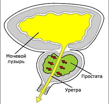 Первая помощь при почечной колике