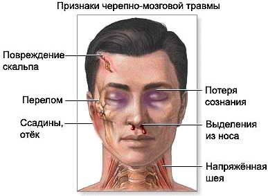 Первая помощь при сотрясении мозга