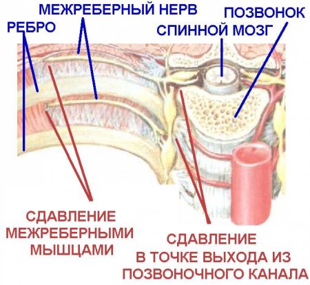 ����������� ��������� - ��� ���