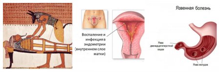 ���������� ���������� � ��������