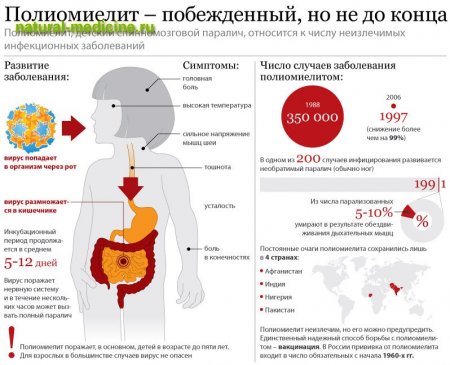 Полиомиелит