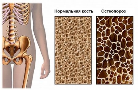 Кальций в организме
