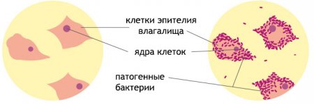 Состав микрофлоры влагалища