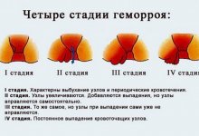 5  ����������� � ������ � ��������
