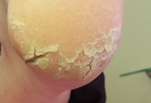 ������������: �������, ��������, �������